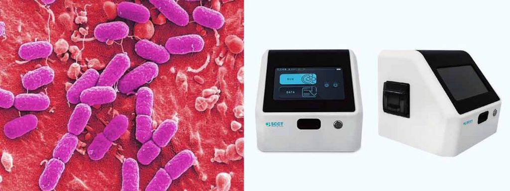 somatic-cells-analyzer-in-milk