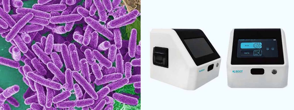 somatic-cells-in-goat-milk