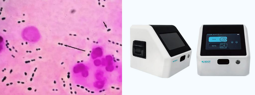 somatic-cells-in-milk-australia