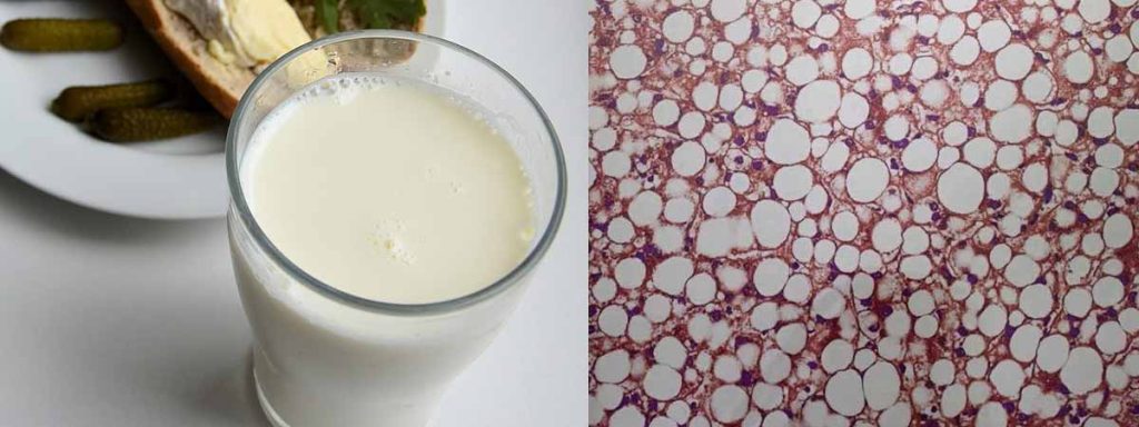 somatic-cells-in-milk-us