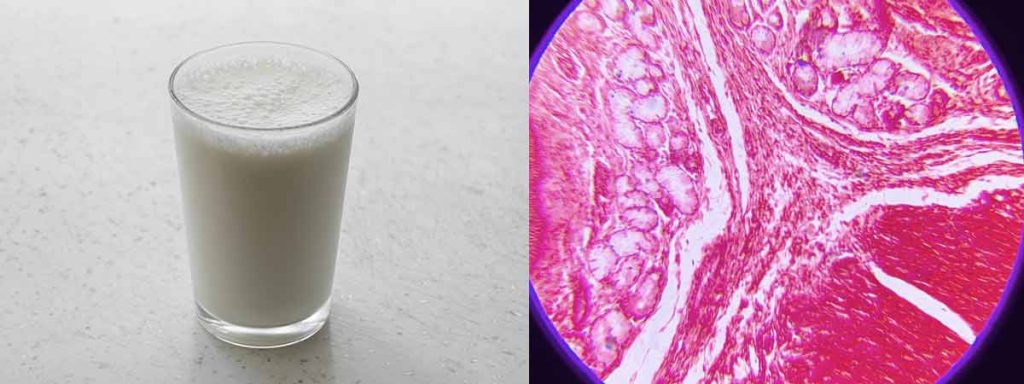 somatic-cells-in-raw-milk