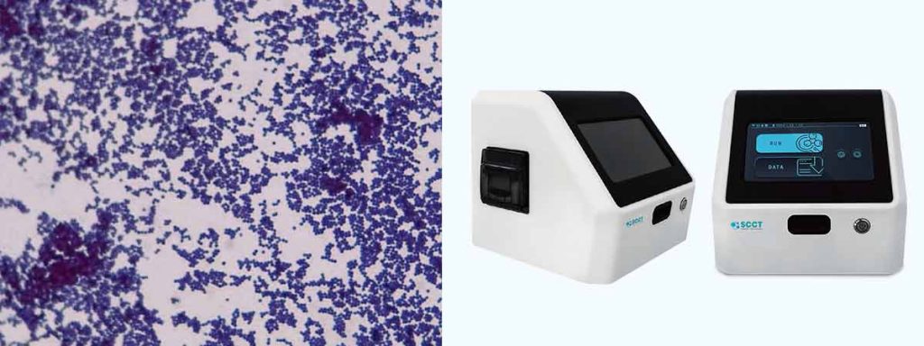 types-of-somatic-cells-in-milk